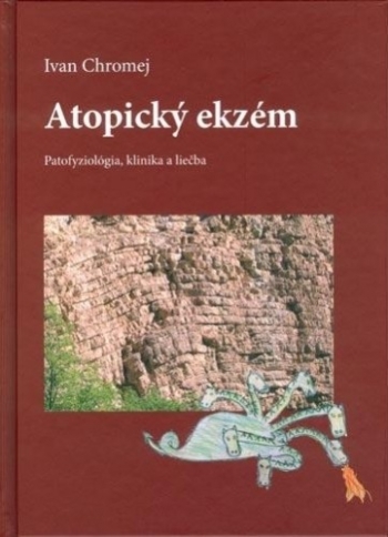 Kniha - Atopický ekzém